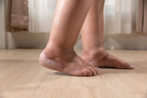 Medical Causes and Symptoms of Swollen Feet