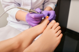 Understanding Laser Therapy for Fungal Nails