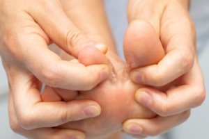 The Role of Dermatophytes in Athlete’s Foot